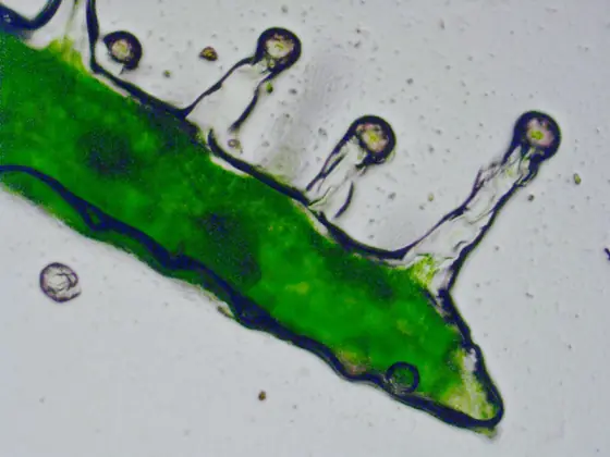 Imagem ao microscópio de pelos glandulares pedunculados (tricomas) numa parte da planta de cannabis